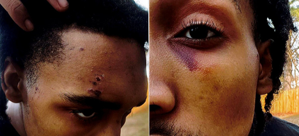 Black Army Vet Says Same Memphis Cops Beat Him Days Before Killing Tyre Nichols