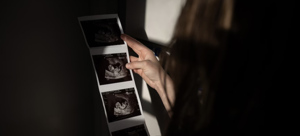 Her Baby Has a Deadly Diagnosis. Her Florida Doctors Refused an Abortion.