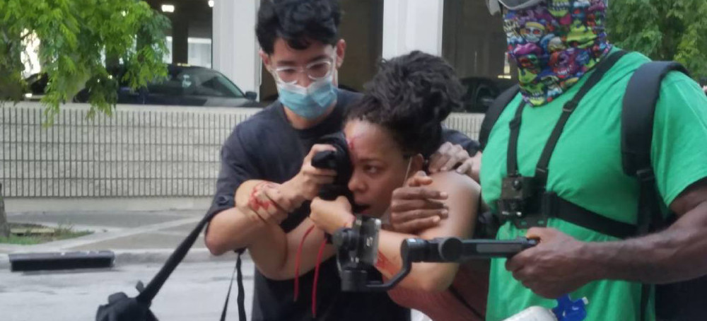 George Floyd Protester Shot in Face With Rubber Bullet Scores a Victory in Legal Fight With Fort Lauderdale