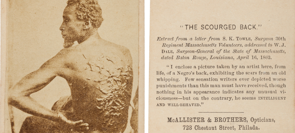 National Park to Remove Photo of Enslaved Man’s Scars