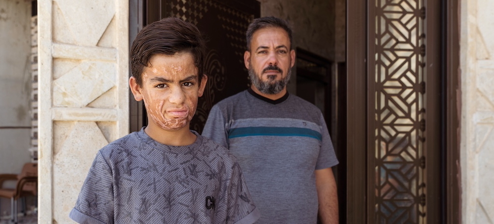 The Many Casualties of Precision Warfare