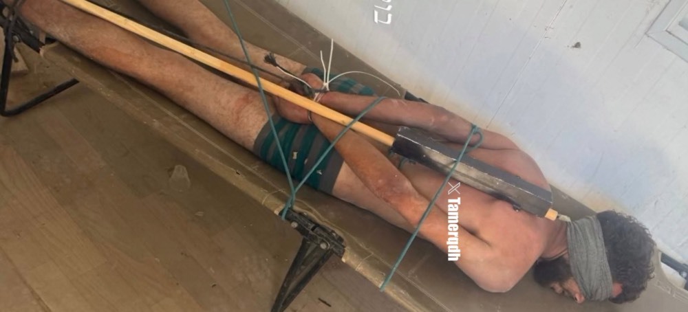 Photo of Bound Palestinian Detainee Corroborates Israeli Torture Reports, Say Rights Groups